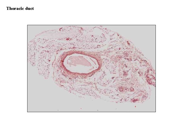 Thoracic duct 