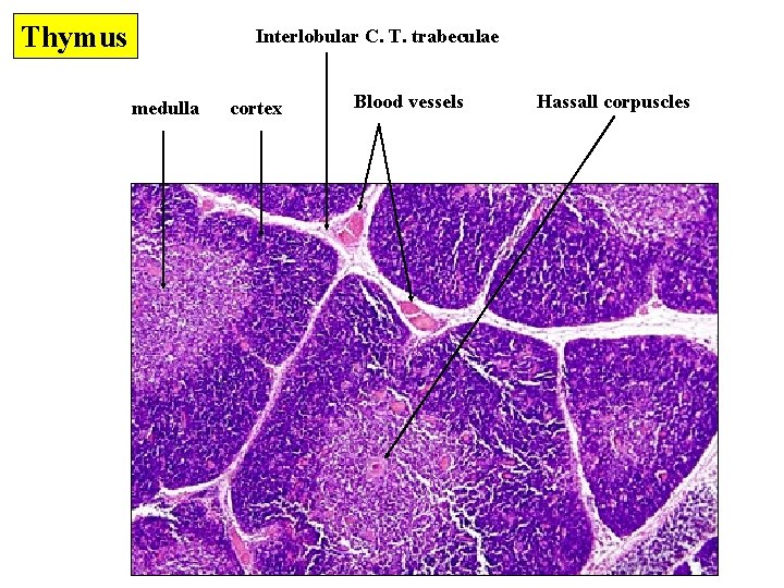 Thymus Interlobular C. T. trabeculae medulla cortex Blood vessels Hassall corpuscles 
