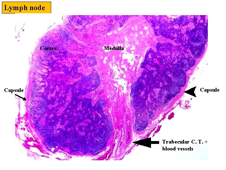 Lymph node Cortex Capsule Medulla Capsule Trabecular C. T. + blood vessels 