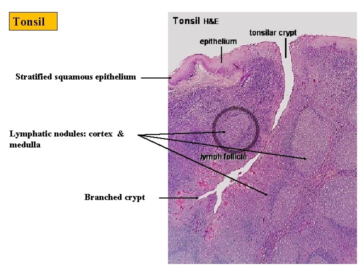 Tonsil Stratified squamous epithelium Lymphatic nodules: cortex & medulla Branched crypt 