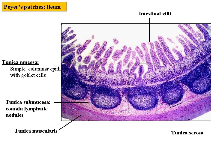 Peyer's patches: ileum Intestinal villi Tunica mucosa: Simple columnar epith. with goblet cells Tunica