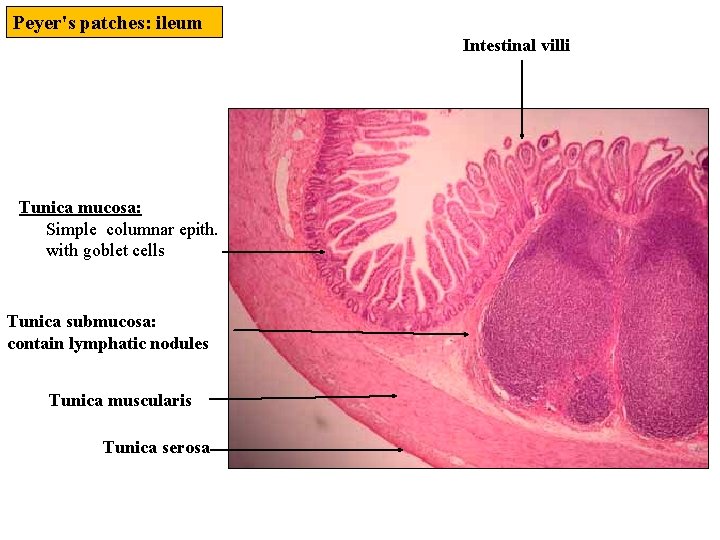 Peyer's patches: ileum Intestinal villi Tunica mucosa: Simple columnar epith. with goblet cells Tunica