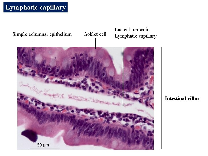 Lymphatic capillary Simple columnar epithelium Goblet cell Lacteal lumen in Lymphatic capillary Intestinal villus