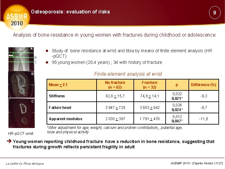 Osteoporosis: evaluation of risks 9 Analysis of bone resistance in young women with fractures