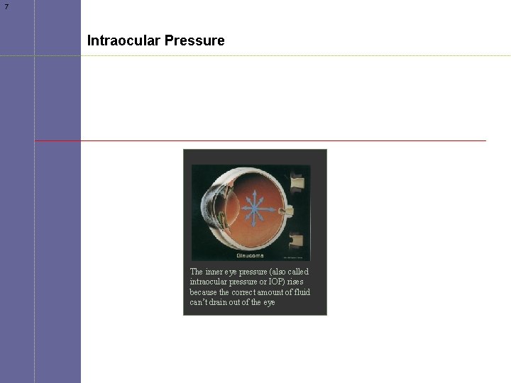 7 Intraocular Pressure The inner eye pressure (also called intraocular pressure or IOP) rises