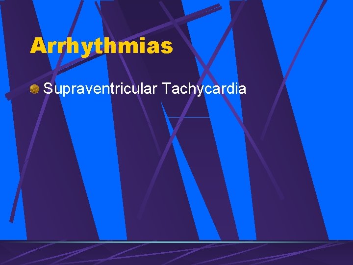 Arrhythmias Supraventricular Tachycardia 