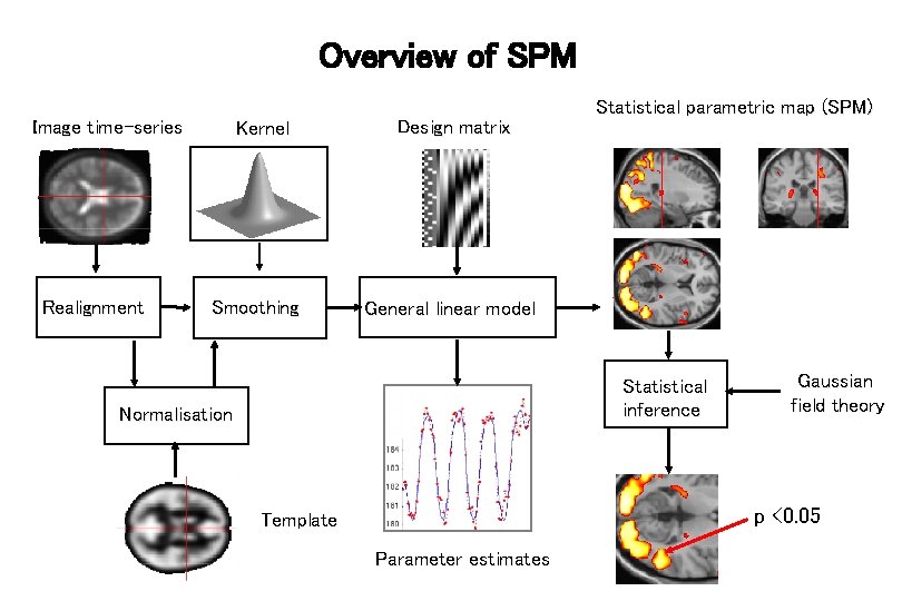 Overview of SPM Image time-series Realignment Kernel Smoothing Design matrix Statistical parametric map (SPM)