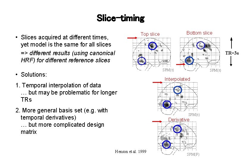 Slice-timing Bottom slice Top slice • Slices acquired at different times, yet model is
