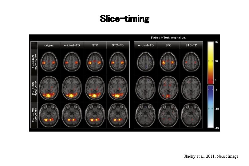 Slice-timing Sladky et al. 2011, Neuro. Image 