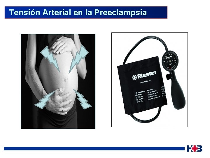  Tensión Arterial en la Preeclampsia 