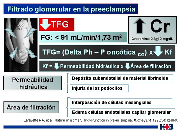  Filtrado glomerular en la preeclampsia TFG FG: < 91 m. L/min/1, 73 m