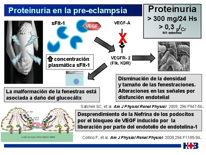  Proteinuria en la pre-eclampsia s. Flt-1 VEGF X Proteinuria > 300 mg/24 Hs