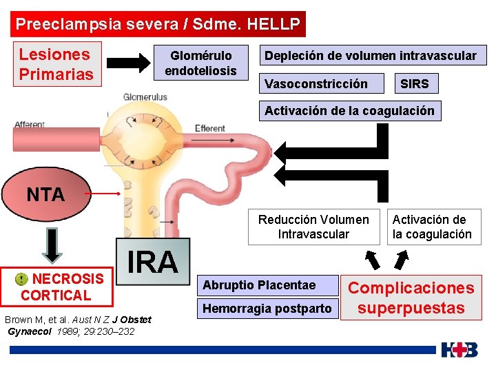 Preeclampsia severa / Sdme. HELLP Lesiones Primarias Glomérulo endoteliosis Depleción de volumen intravascular Vasoconstricción