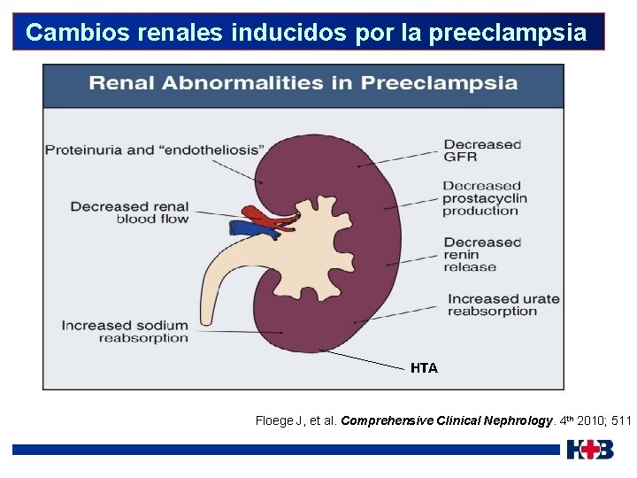  Cambios renales inducidos por la preeclampsia HTA Floege J, et al. Comprehensive Clinical
