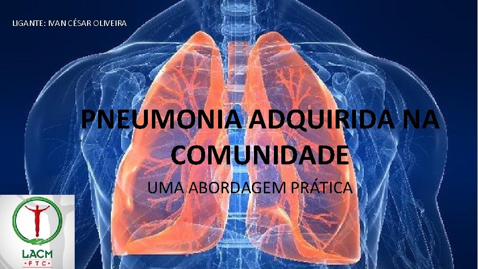 LIGANTE: IVAN CÉSAR OLIVEIRA PNEUMONIA ADQUIRIDA NA COMUNIDADE UMA ABORDAGEM PRÁTICA LIGANTE: IVAN CÉSAR OLIVEIRA PNEUMONIA ADQUIRIDA NA COMUNIDADE UMA ABORDAGEM PRÁTICA