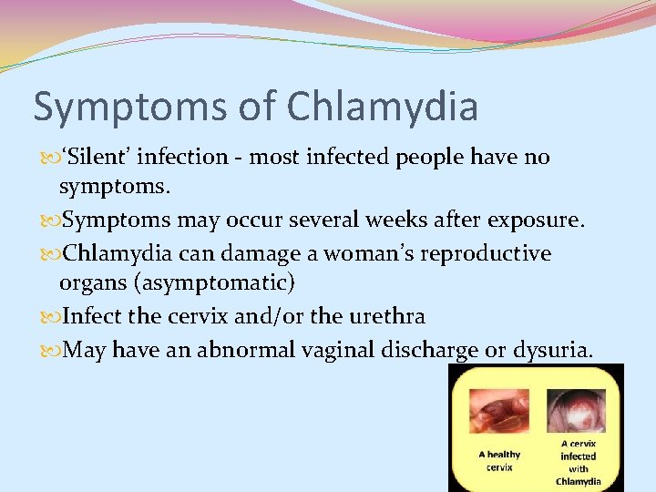 Symptoms of Chlamydia ‘Silent’ infection - most infected people have no symptoms. Symptoms may Symptoms of Chlamydia ‘Silent’ infection - most infected people have no symptoms. Symptoms may