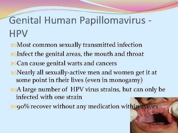 Genital Human Papillomavirus HPV Most common sexually transmitted infection Infect the genital areas, the Genital Human Papillomavirus HPV Most common sexually transmitted infection Infect the genital areas, the