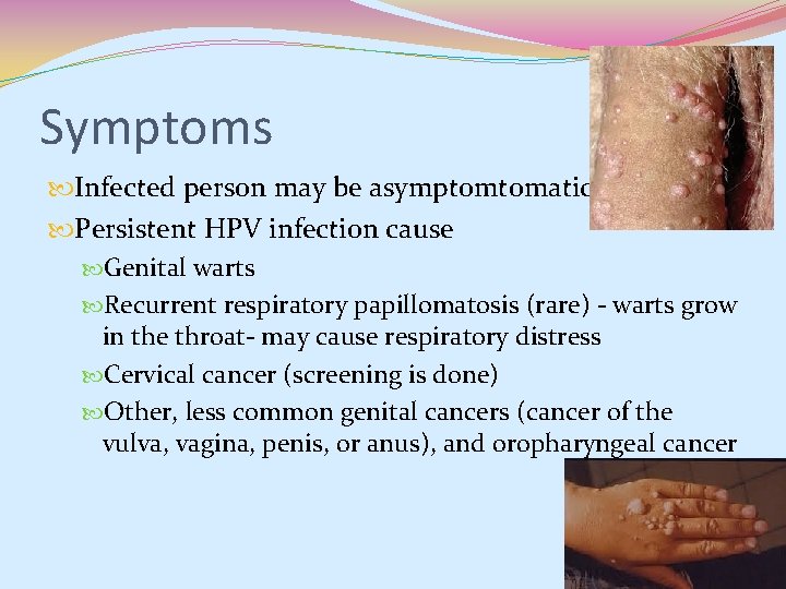 Symptoms Infected person may be asymptomtomatic Persistent HPV infection cause Genital warts Recurrent respiratory Symptoms Infected person may be asymptomtomatic Persistent HPV infection cause Genital warts Recurrent respiratory