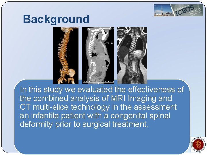 Background In this study we evaluated the effectiveness of the combined analysis of MRI