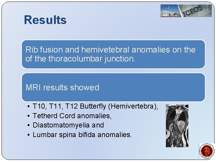 Results Rib fusion and hemivetebral anomalies on the of the thoracolumbar junction. MRI results