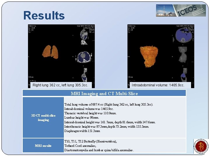 Results Right lung 362 cc, left lung 305. 3 cc. Introabdominal volume: 1465. 9