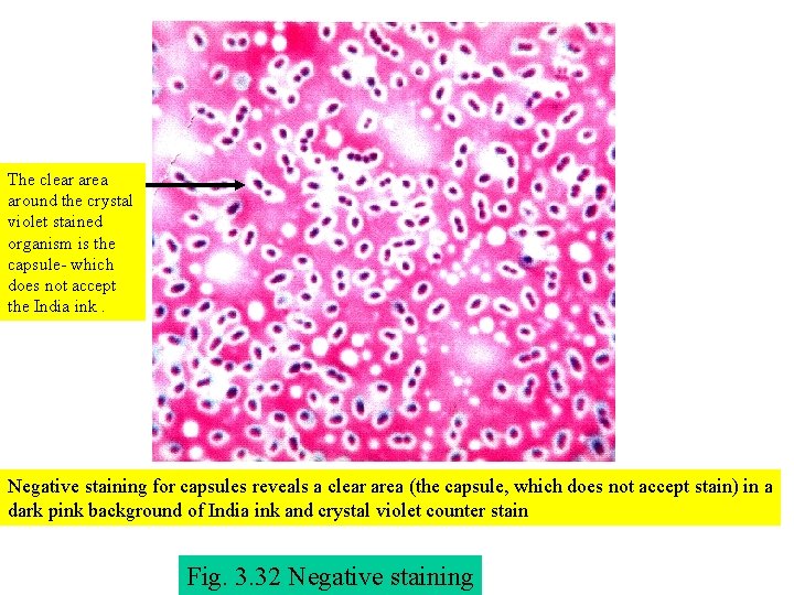 The clear area around the crystal violet stained organism is the capsule- which does