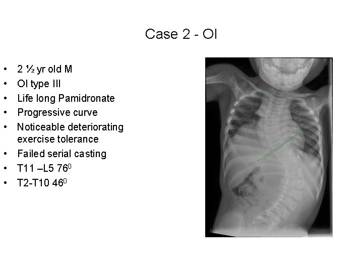 Case 2 - OI • • • 2 ½ yr old M OI type Case 2 - OI • • • 2 ½ yr old M OI type