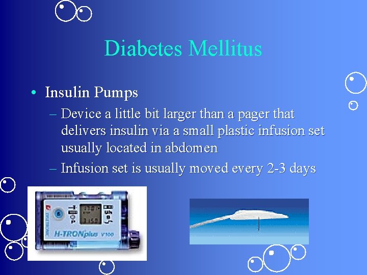 Diabetes Mellitus • Insulin Pumps – Device a little bit larger than a pager Diabetes Mellitus • Insulin Pumps – Device a little bit larger than a pager