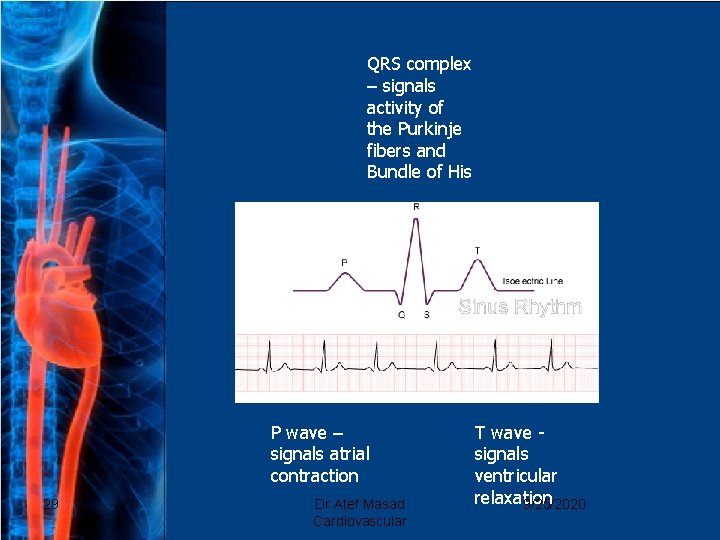 QRS complex – signals activity of the Purkinje fibers and Bundle of His P