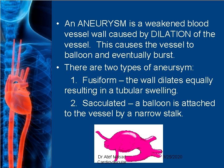  • An ANEURYSM is a weakened blood vessel wall caused by DILATION of