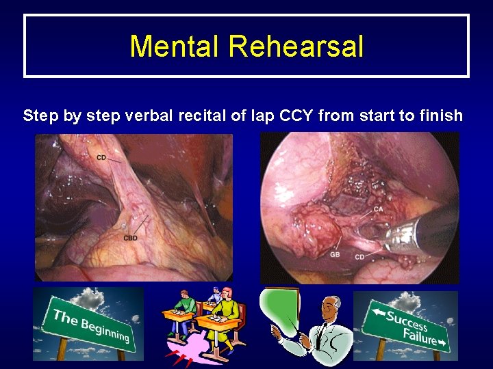 Mental Rehearsal Step by step verbal recital of lap CCY from start to finish