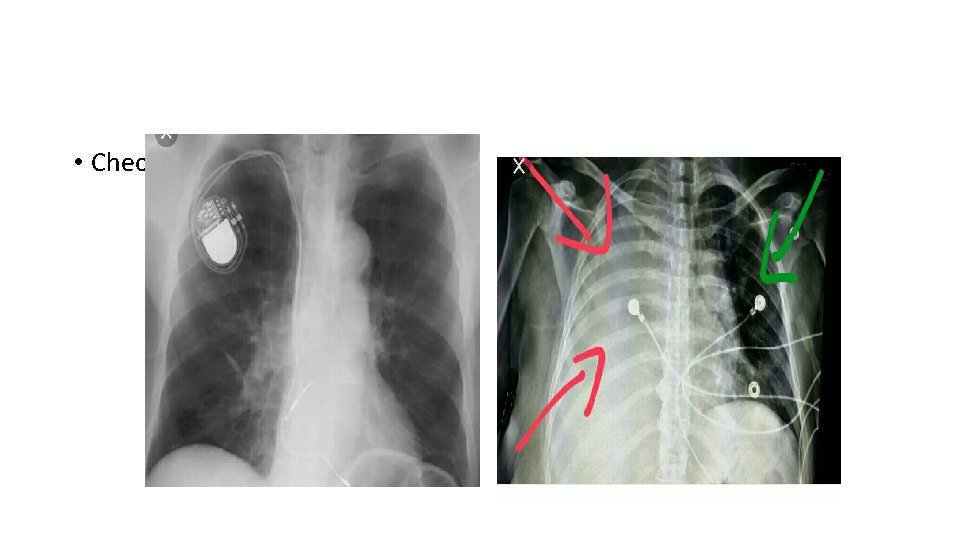  • Check if there any instrument 