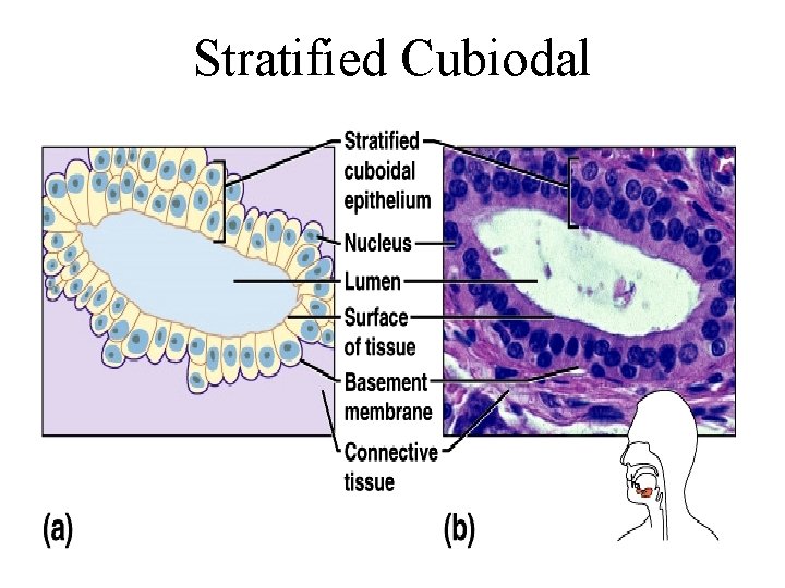 Stratified Cubiodal 
