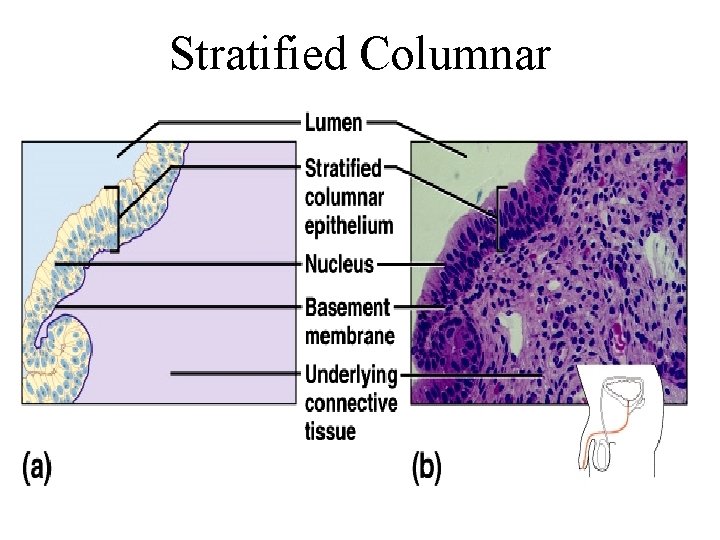Stratified Columnar 