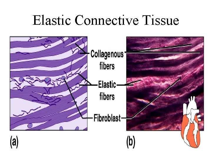 Elastic Connective Tissue 