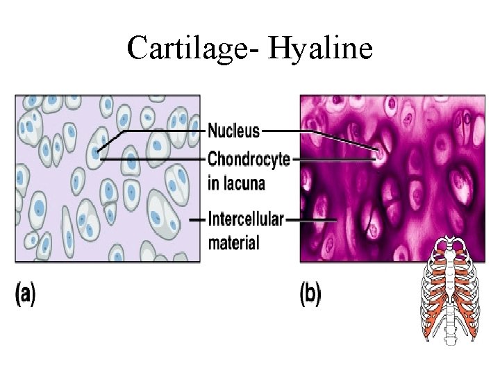 Cartilage- Hyaline 