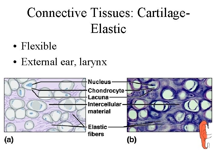 Connective Tissues: Cartilage. Elastic • Flexible • External ear, larynx 