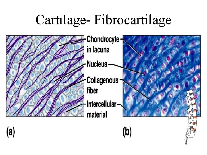 Cartilage- Fibrocartilage 