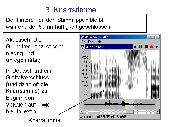 3. Knarrstimme Der hintere Teil der Stimmlippen bleibt während der Stimmhaftigkeit geschlossen Akustisch: Die