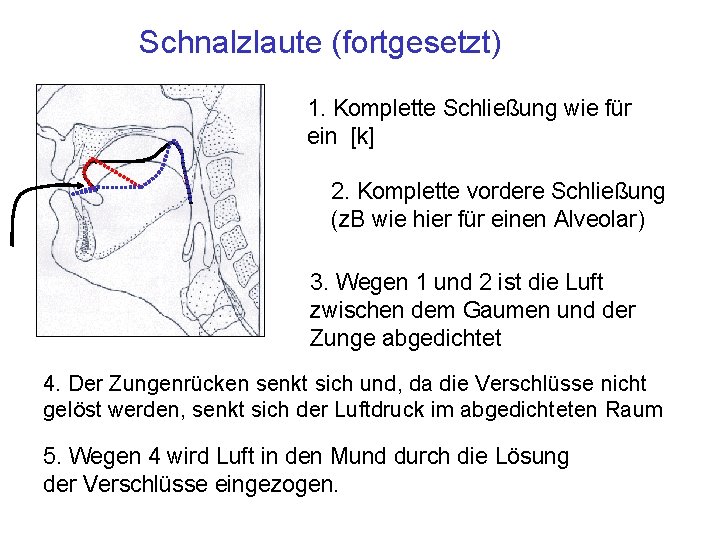 Schnalzlaute (fortgesetzt) 1. Komplette Schließung wie für ein [k] 2. Komplette vordere Schließung (z.