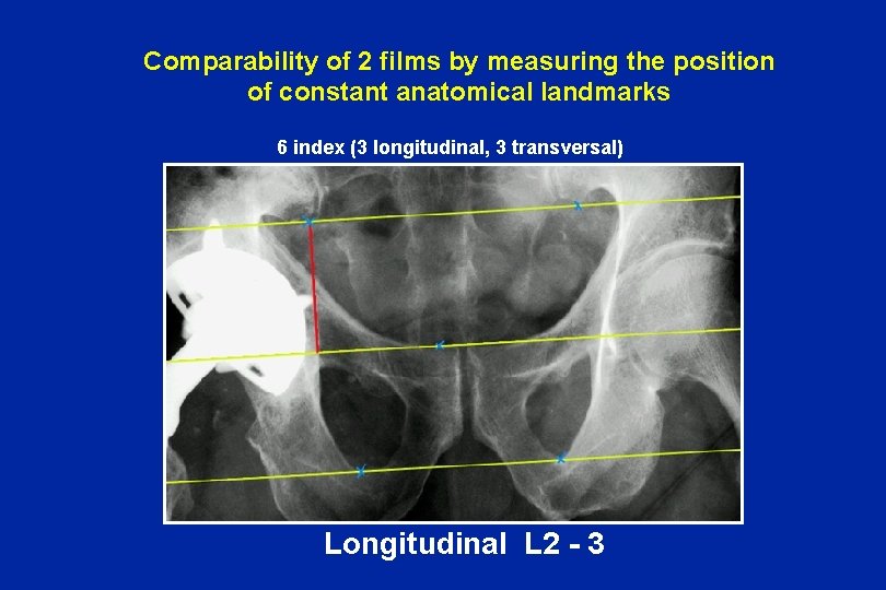 Comparability of 2 films by measuring the position of constant anatomical landmarks 6 index