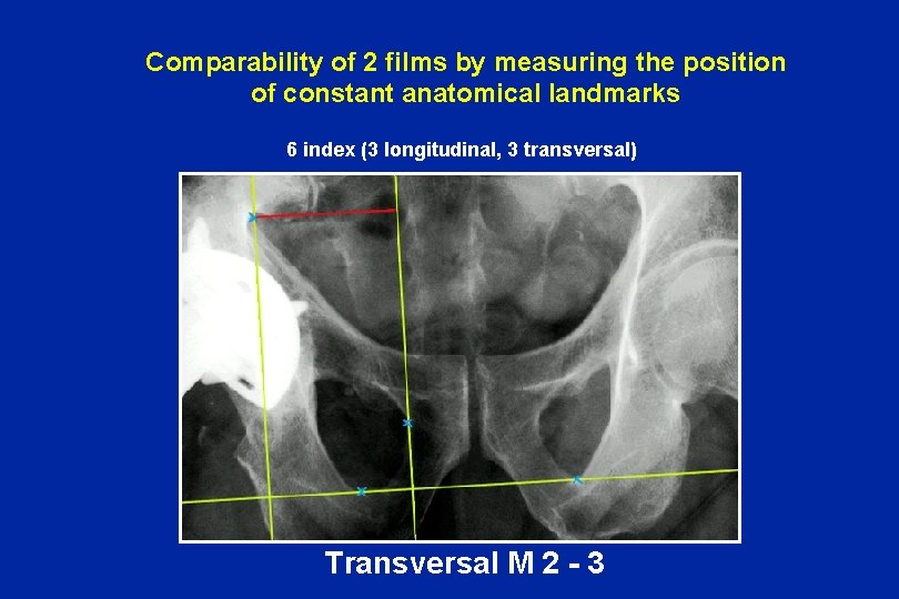 Comparability of 2 films by measuring the position of constant anatomical landmarks 6 index