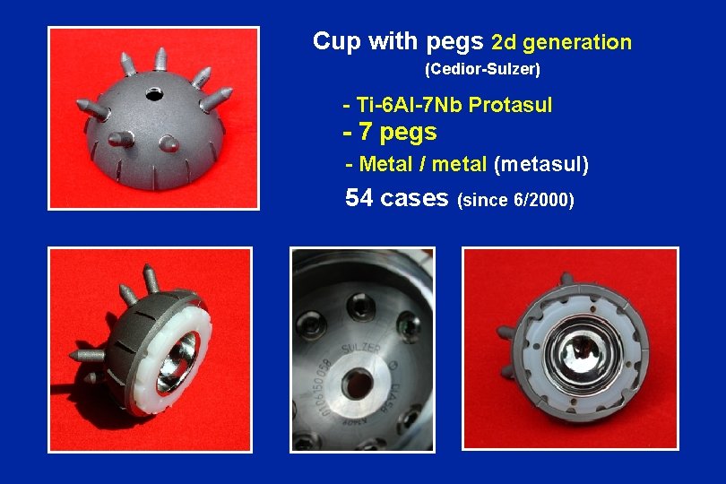 Cup with pegs 2 d generation (Cedior-Sulzer) - Ti-6 Al-7 Nb Protasul - 7