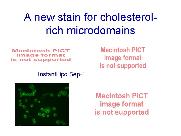 A new stain for cholesterolrich microdomains Instant. Lipo Sep-1 