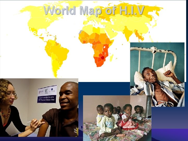 World Map of H. I. V 3. Diseases - HIV - Malaria 