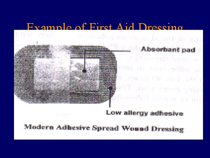 Example of First Aid Dressing 