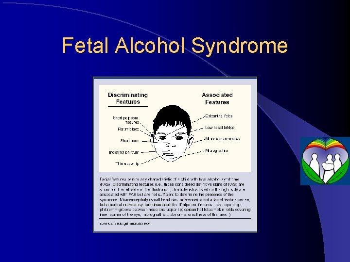 Fetal Alcohol Syndrome 