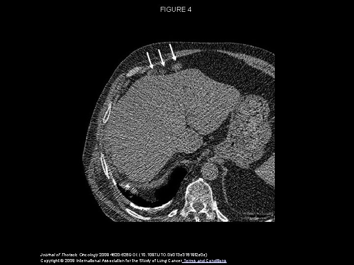 how long to get biopsy results for oral cancer