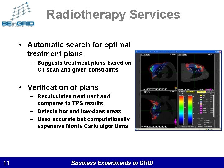 Radiotherapy Services • Automatic search for optimal treatment plans – Suggests treatment plans based