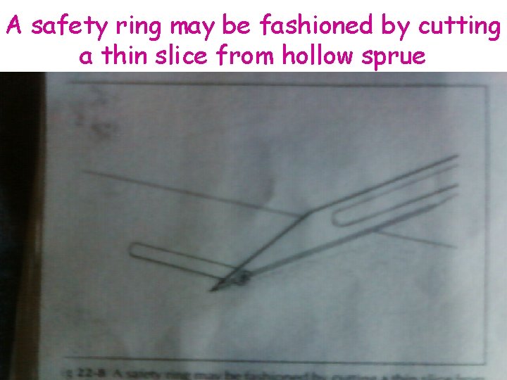 A safety ring may be fashioned by cutting a thin slice from hollow sprue